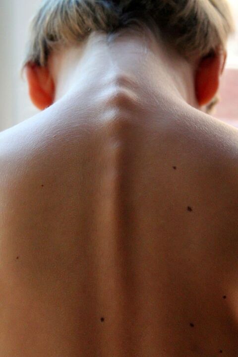 กระดูกสันหลัง